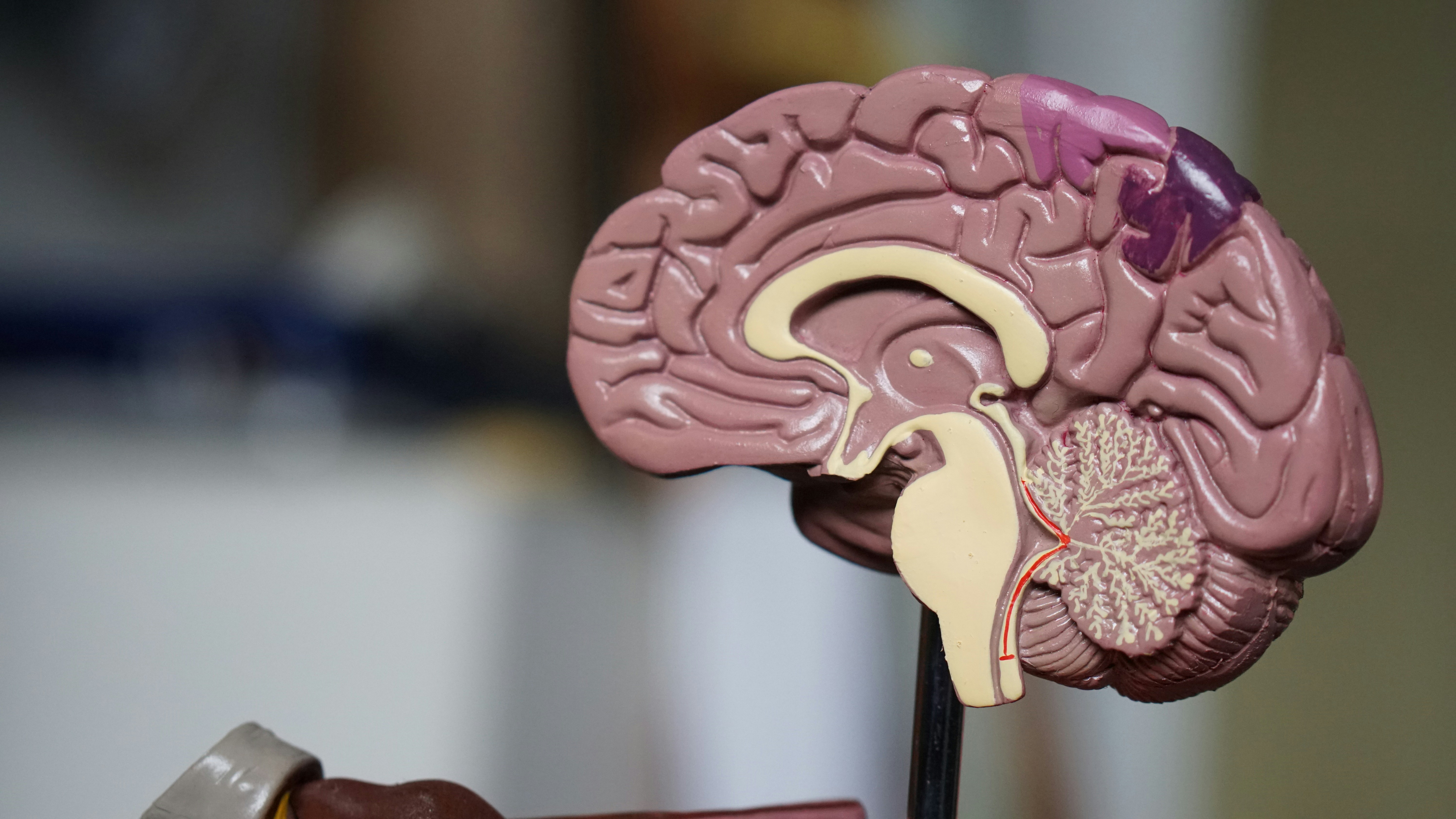 Understanding Dementia: Exploring neurodegenerative disease through real world case studies